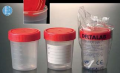 Универсални контейнери стерилни, PP, 150 ml, опаковка от 350 бр.